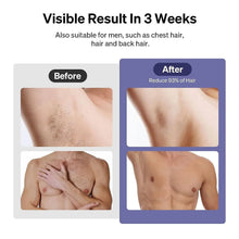 Lade das Bild in den Galerie-Viewer, Professional 808nm Diode Laser Hair Removal Device for Home or Salon Use