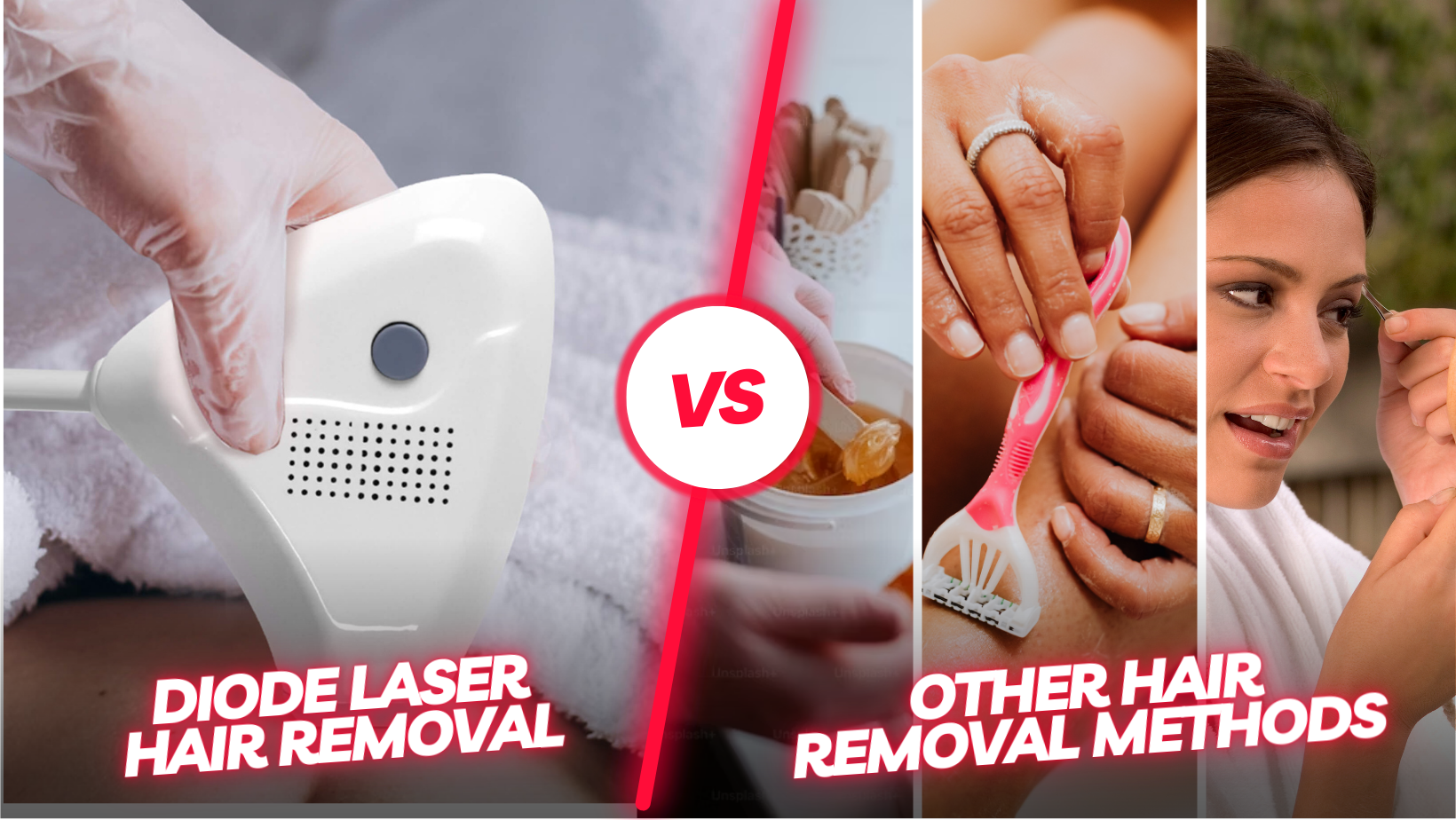 Comparing Diode Laser Hair Removal to Other Hair Removal Methods