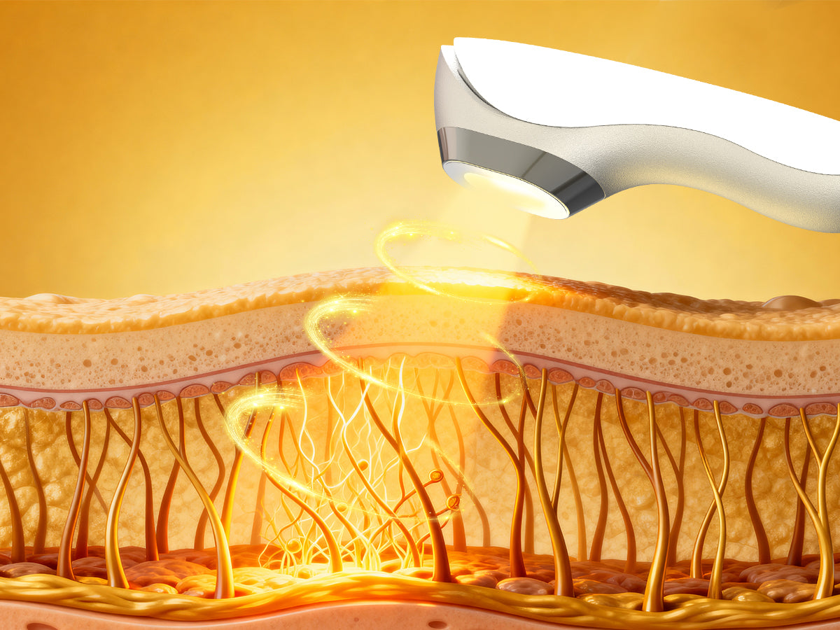 Lumirea DPL & NIR Photofacial Skincare Device